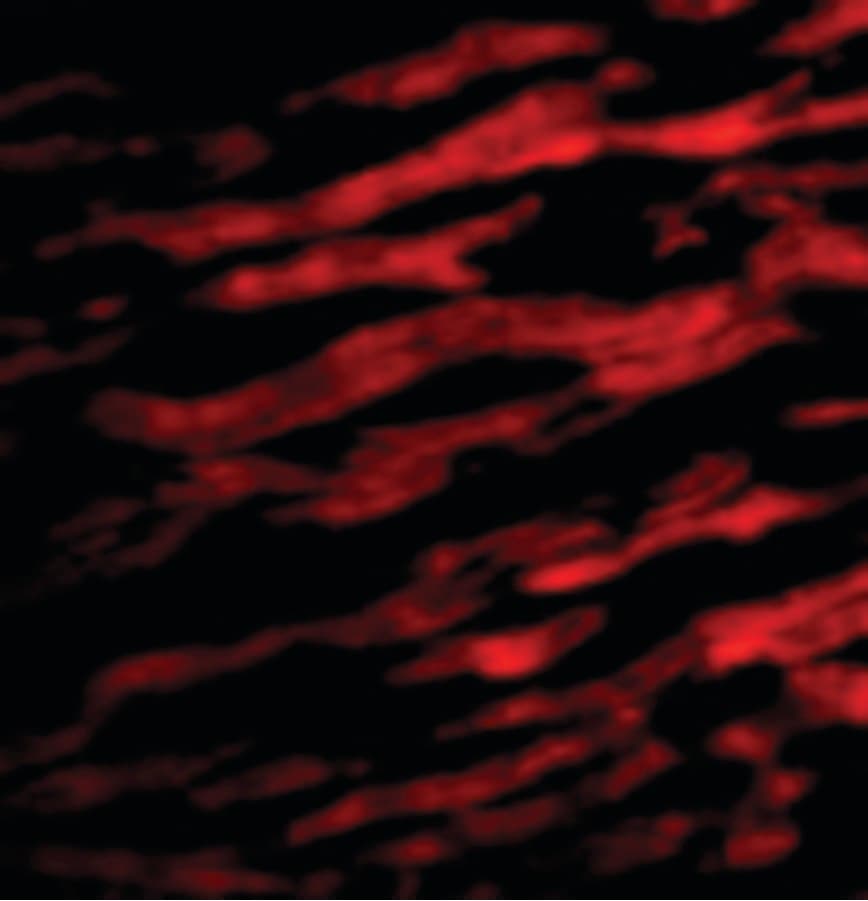 IHC-plus™ TIRAP Antibody