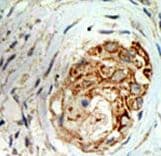 Polyclonal Rabbit anti-Human MBD3 Antibody (aa264-291, IHC, WB)