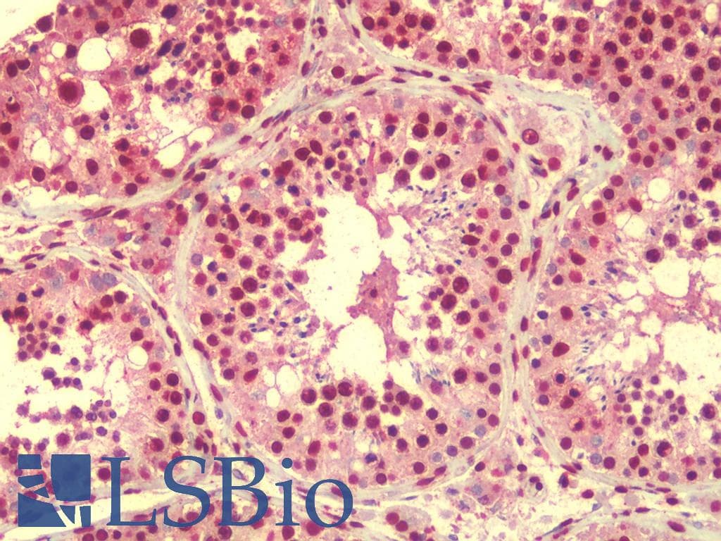 IHC-plus™ RASSF10 Antibody