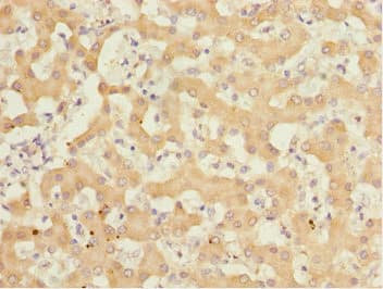 Polyclonal Rabbit anti-Human GABARAPL1 / ATG8 Antibody (IHC)
