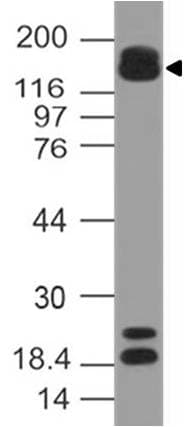 ARID5B Antibody