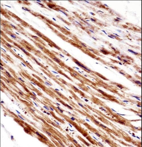 PLA2G5 Antibody (aa103-132)