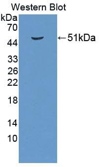 PUS1 Antibody (APC)