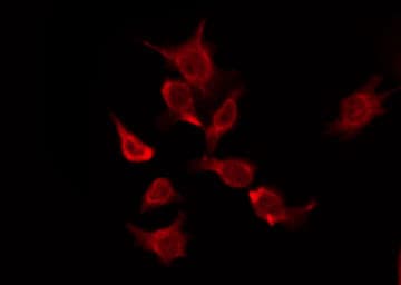 OR5P2 Antibody