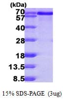 Human BLNK Protein (Recombinant His)
