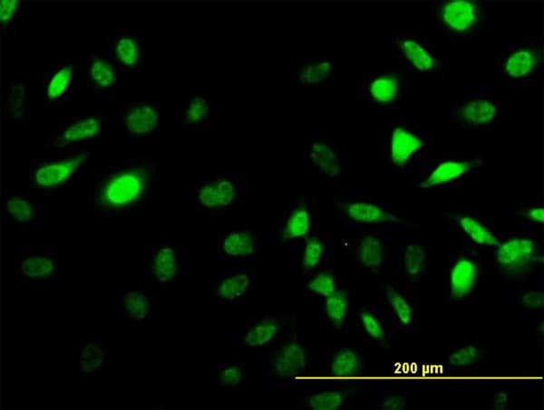 SESN2 / HI95 Antibody (clone 3B8)