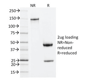 ZAP70 Antibody (clone ZAP70/2035)
