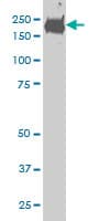 CDC42BPB / MRCKB Antibody (clone 6G3)