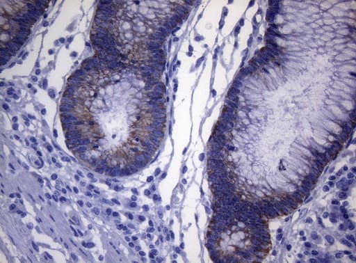 KRT18 / CK18 / Cytokeratin 18 Antibody (aa69-372, clone OTI5E4, Carrier-free)
