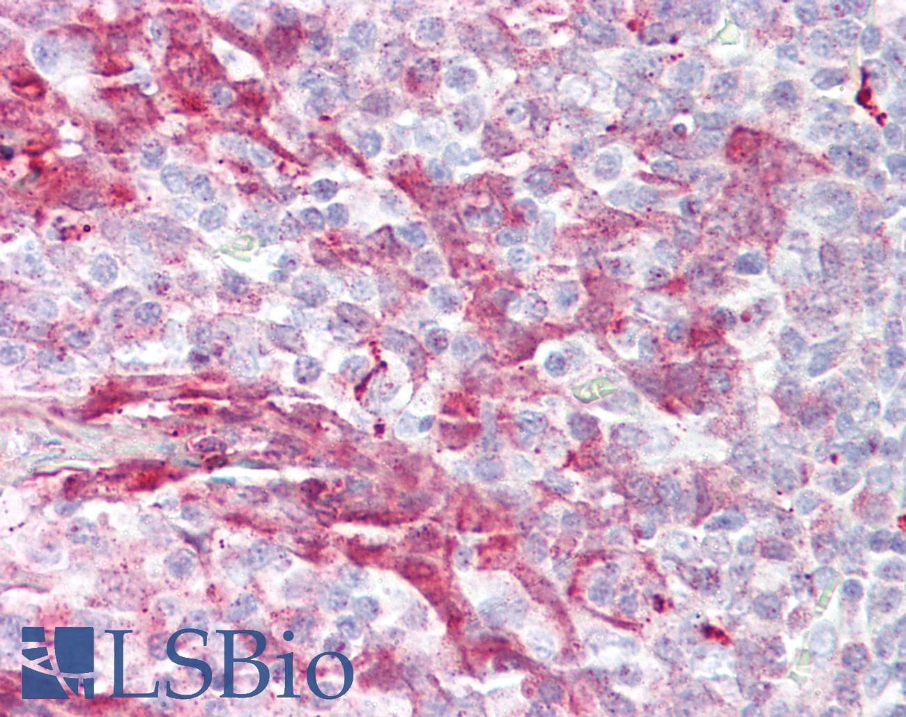 IHC-plus™ MARCKS Antibody (aa136-185)