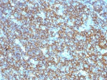 Polyclonal Rabbit anti-Human CD20 Antibody (IHC, IF)