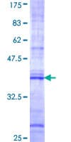 Human FNBP1 / FBP17 Protein (Recombinant GST, N-terminus)