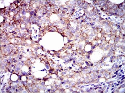 Monoclonal Mouse anti-Human ITGB1 / Integrin Beta 1 / CD29 Antibody (clone 3B6, IHC, WB)