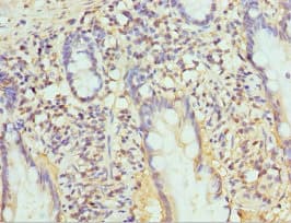 Polyclonal Rabbit anti-Human PSMB10 Antibody (IHC)