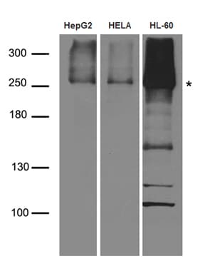 Polyclonal Rabbit anti-Human CAD Antibody (WB)