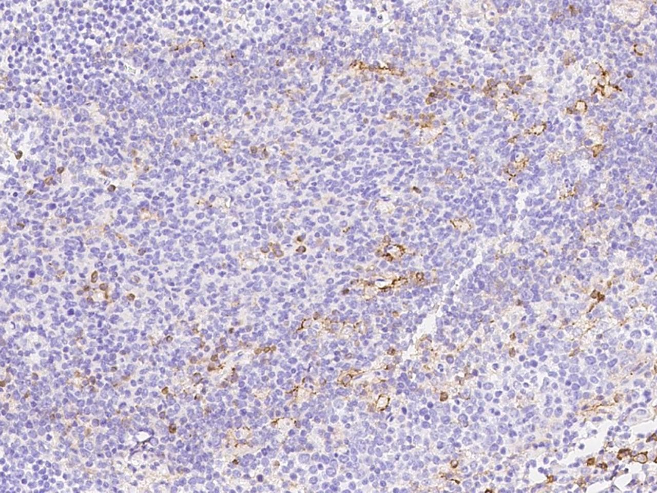 SELPLG / PSGL-1 / CD162 Antibody (clone 216, Preservative Free)
