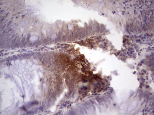 TCF12 / HEB Antibody (aa1-250, clone OTI4D6)