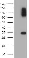 SULT1A1 / Sulfotransferase 1A1 Antibody (clone OTI5A1)