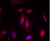 ATF2 Antibody