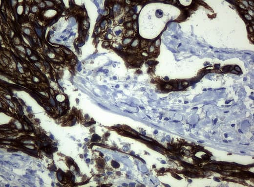 KRT19 / CK19 / Cytokeratin 19 Antibody (aa240-390, clone UMAB3, Carrier-free)