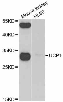 UCP1 / UCP-1 Antibody