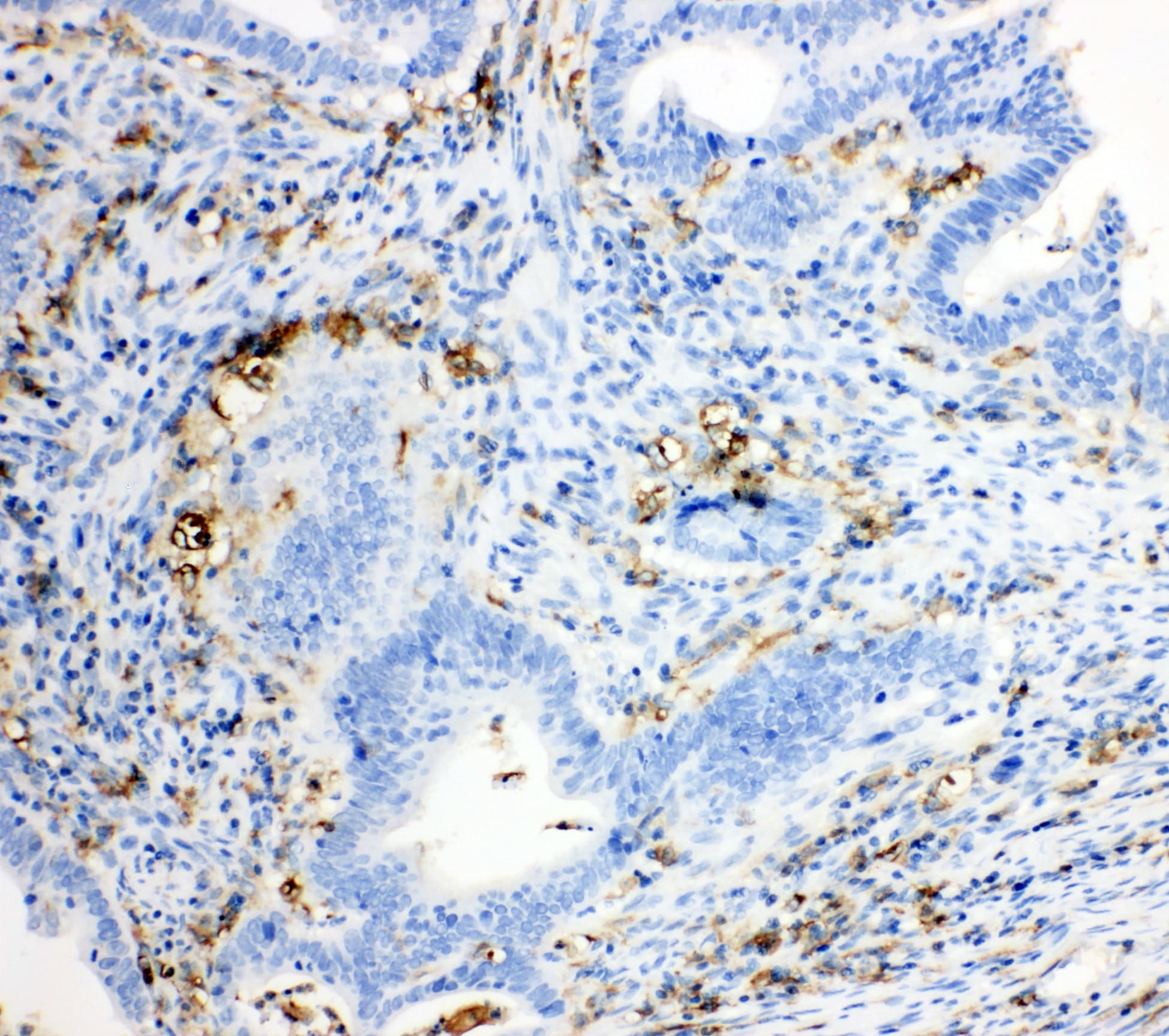 Polyclonal Rabbit anti-Human TRPC6 Antibody (aa249-265, IHC, WB)