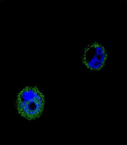 Polyclonal Rabbit anti-Human VPS52 / SACM2L Antibody (aa610-637, IHC, IF, WB)