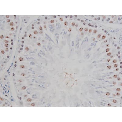 Polyclonal Rabbit anti-Human CHUK / IKKA / IKK Alpha Antibody (phospho-Ser180,phospho-Ser181, IHC, IF, WB)