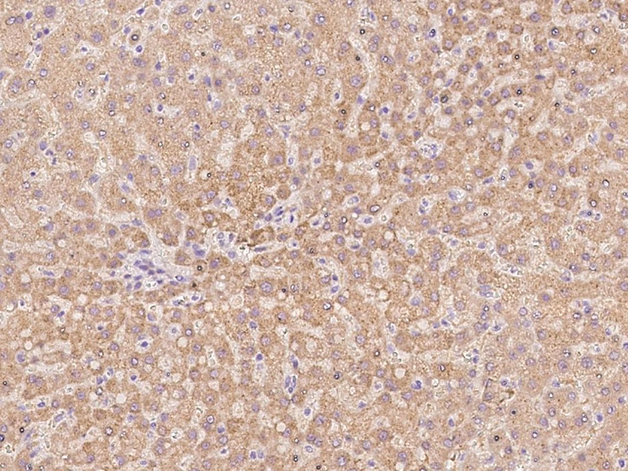 Polyclonal Rabbit anti-Human SLC25A2 Antibody (IHC)