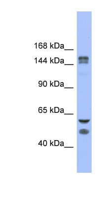 KDM2B / FBXL10 Antibody (C-Terminus)