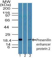 PSENEN / PEN-2 Antibody (aa1-50)