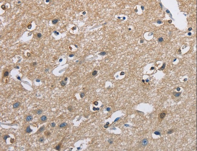 CAB39L Antibody