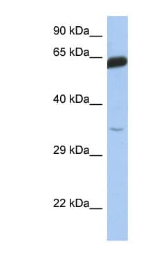 Polyclonal Rabbit anti-Human TCF7 Antibody (C-Terminus, WB)