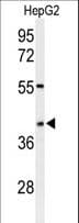 WDR82 / TMEM113 Antibody (aa1-30)