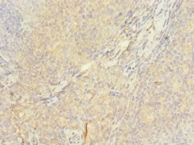 Polyclonal Rabbit anti-Human ASCC1 Antibody (IHC)