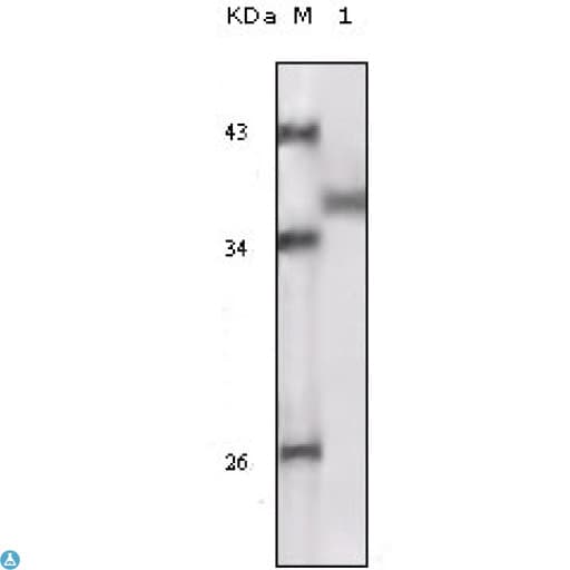 RPS6KA1 / RSK1 Antibody