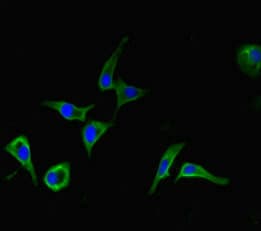 Polyclonal Rabbit anti-Human DDX33 / DHX33 Antibody (IHC, IF, WB)