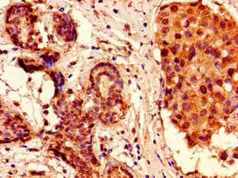 HIST1H2AI Antibody