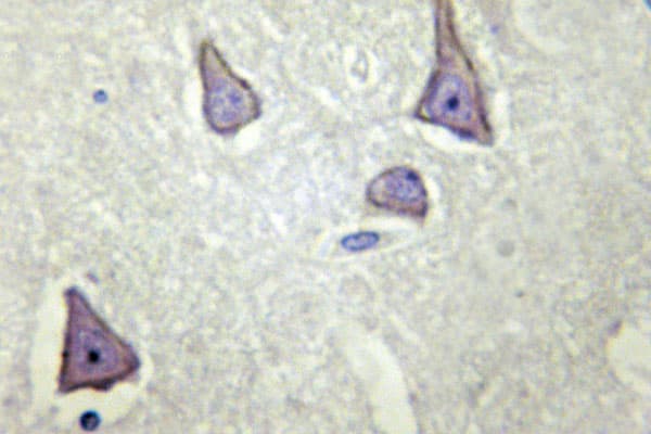 KCNJ11 / Kir6.2 Antibody (Val220)