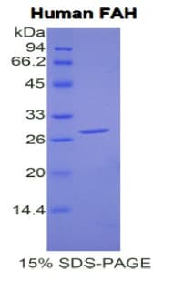 Human FAH Protein (Recombinant His)