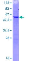Human Aprataxin / APTX Protein (Recombinant GST)