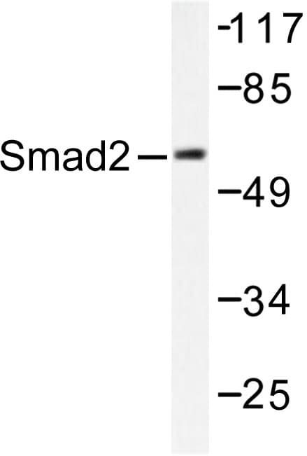 SMAD2 Antibody (Pro459)