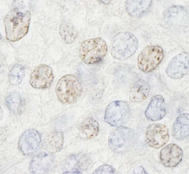 HDAC7 Antibody (aa902-952)