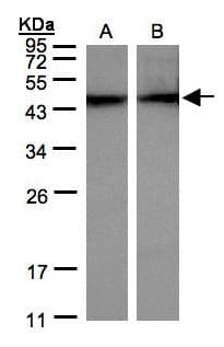 IHC-plus™ ACTC1 / Alpha Cardiac Actin Antibody (aa99-354)
