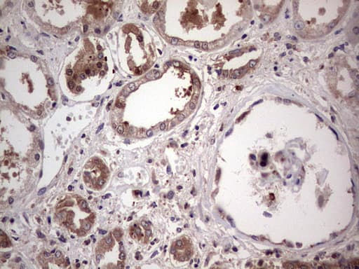 Monoclonal Mouse anti-Human PKM2 Antibody (clone 11B11, IHC, WB)