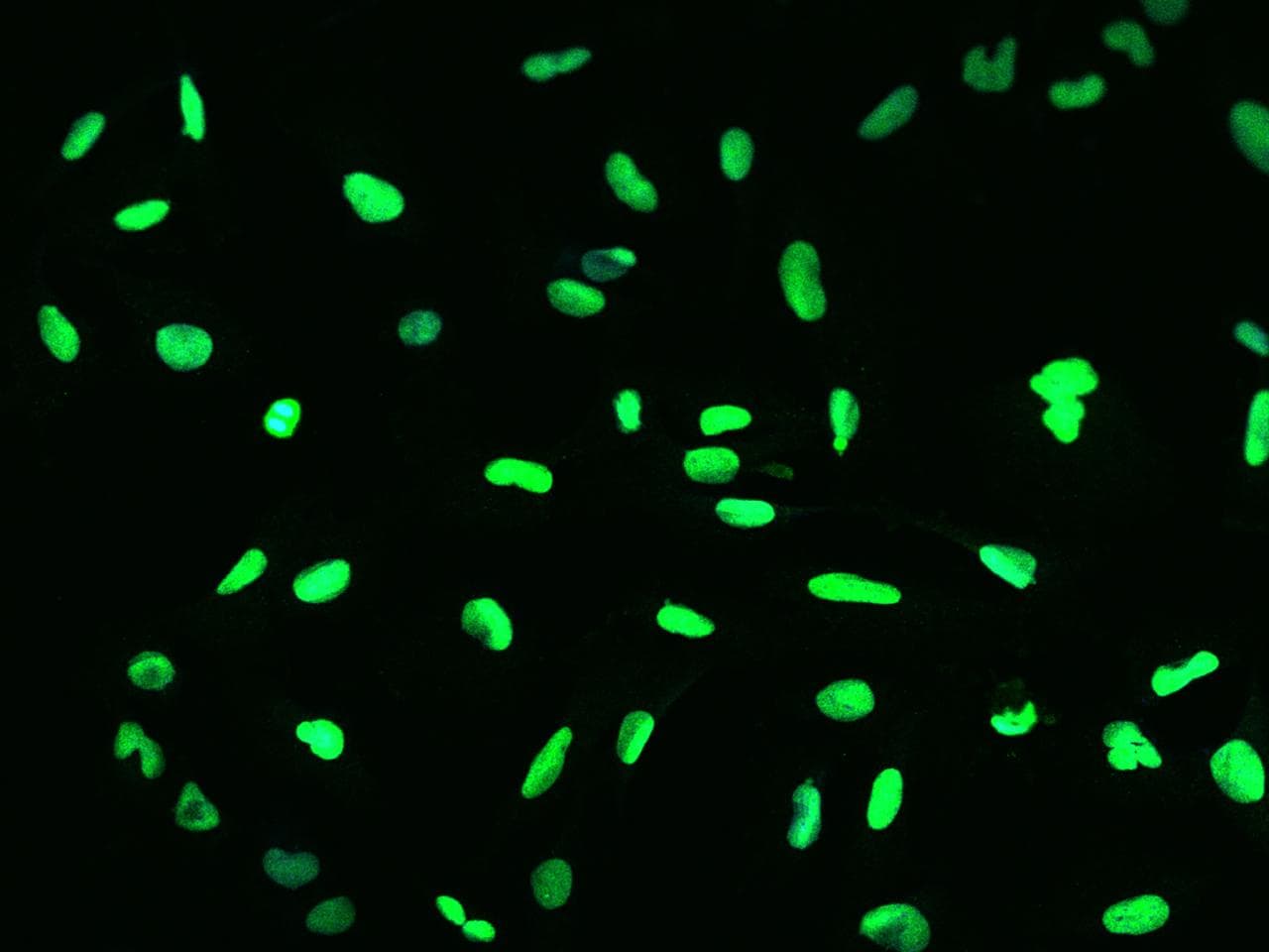 RAP30 / GTF2F2 Antibody