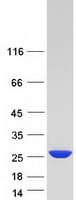 Human NUDT16 Protein (Recombinant Myc-DDK (Flag))