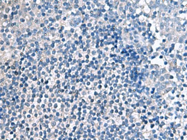 Polyclonal Rabbit anti-Human EIF4A2 Antibody (IHC)