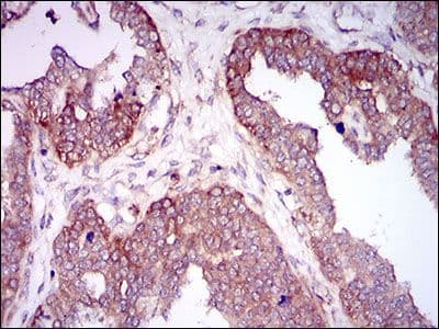 Monoclonal Mouse anti-Human HAS2 Antibody (clone 40000000, Amino Acid: 67-170, IHC, IF, WB)