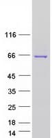 Human THUMPD3 Protein (Recombinant Myc-DDK (Flag))
